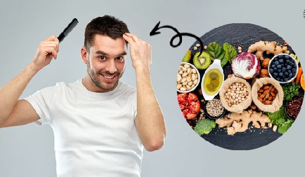 بعد از کاشت مو چی بخوریم؟ راهنمای تقویت و تغذیه بعد کاشت مو