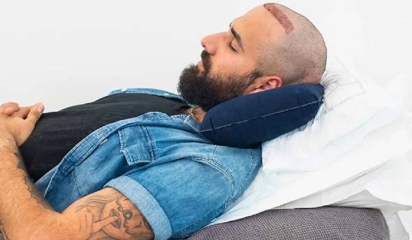 نحوه خوابیدن بعد از کاشت مو چگونه است + نکات مراقبتی